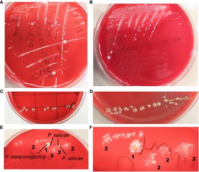 Isolation, identification, and significance of salivary Veillonella spp., Prevotella spp., and Prevotella salivae in patients with inflammatory bowel disease